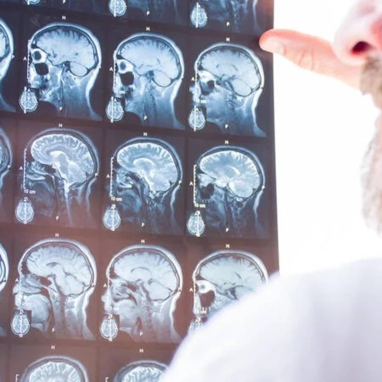 A shot over the shoulder from behind a bearded man wearing a white lab coat, holding a grid of brain scans up to a light wall to inspect them