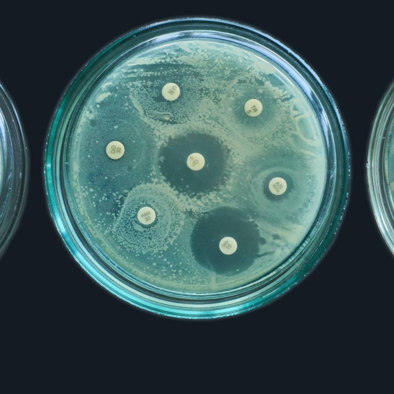 3 green cell culture agar plates show differing amounts of bacterial growth