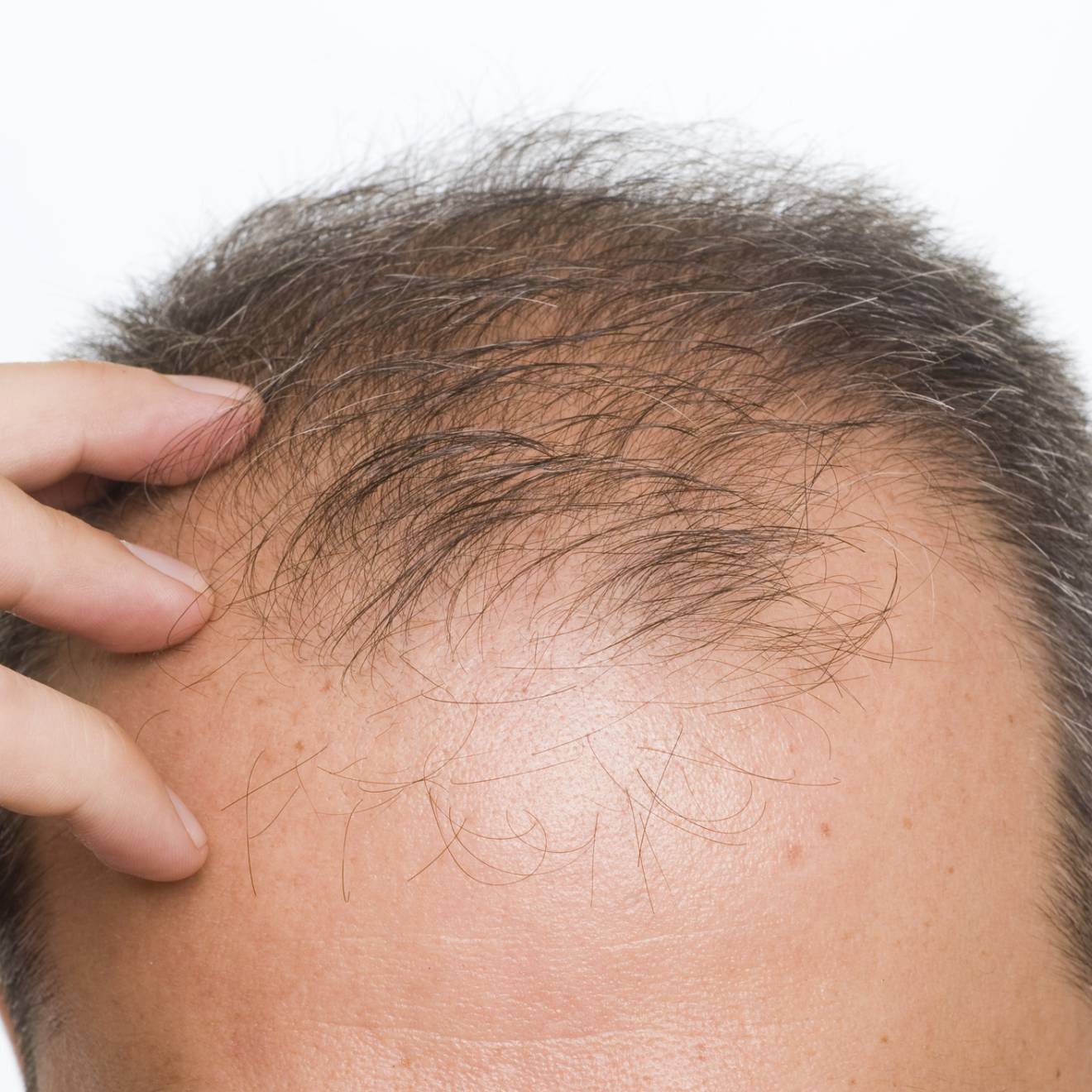 Man scratching bald head, only top of head visible