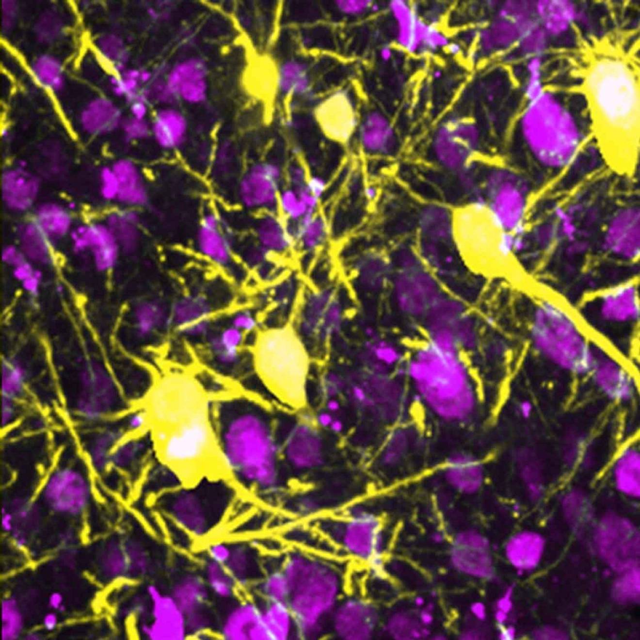 neurons imaged in bright pink and yellow colors