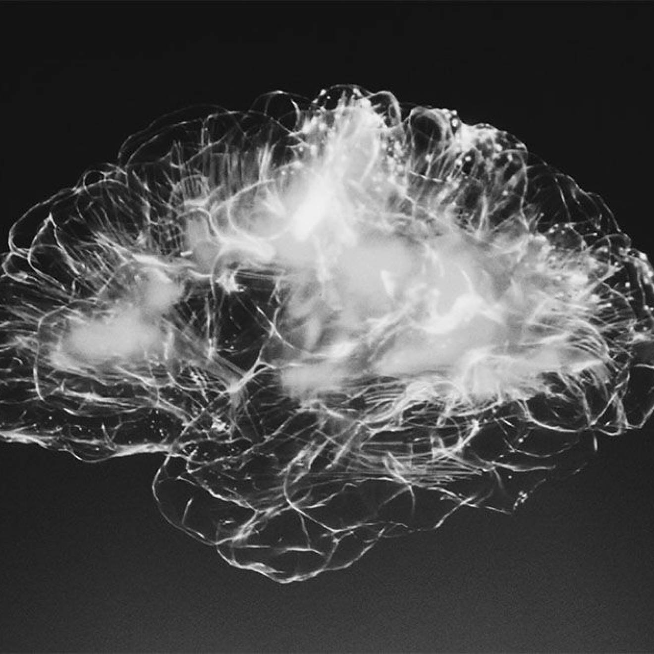 A 3-D-looking scan of a brain appears white against a dark background