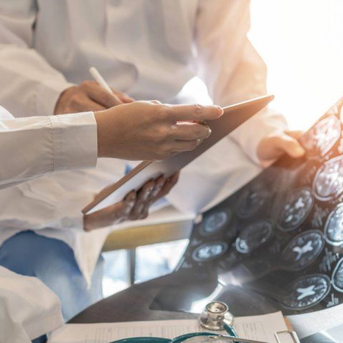 Doctors holding brain scans