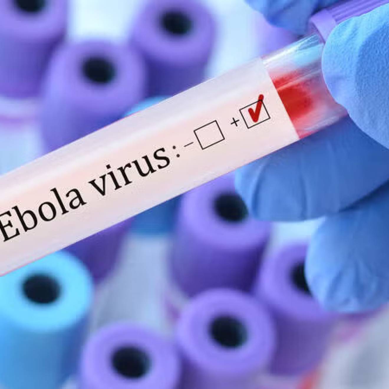 A pipette that says Ebola virus with a plus or minus check held by a gloved hand