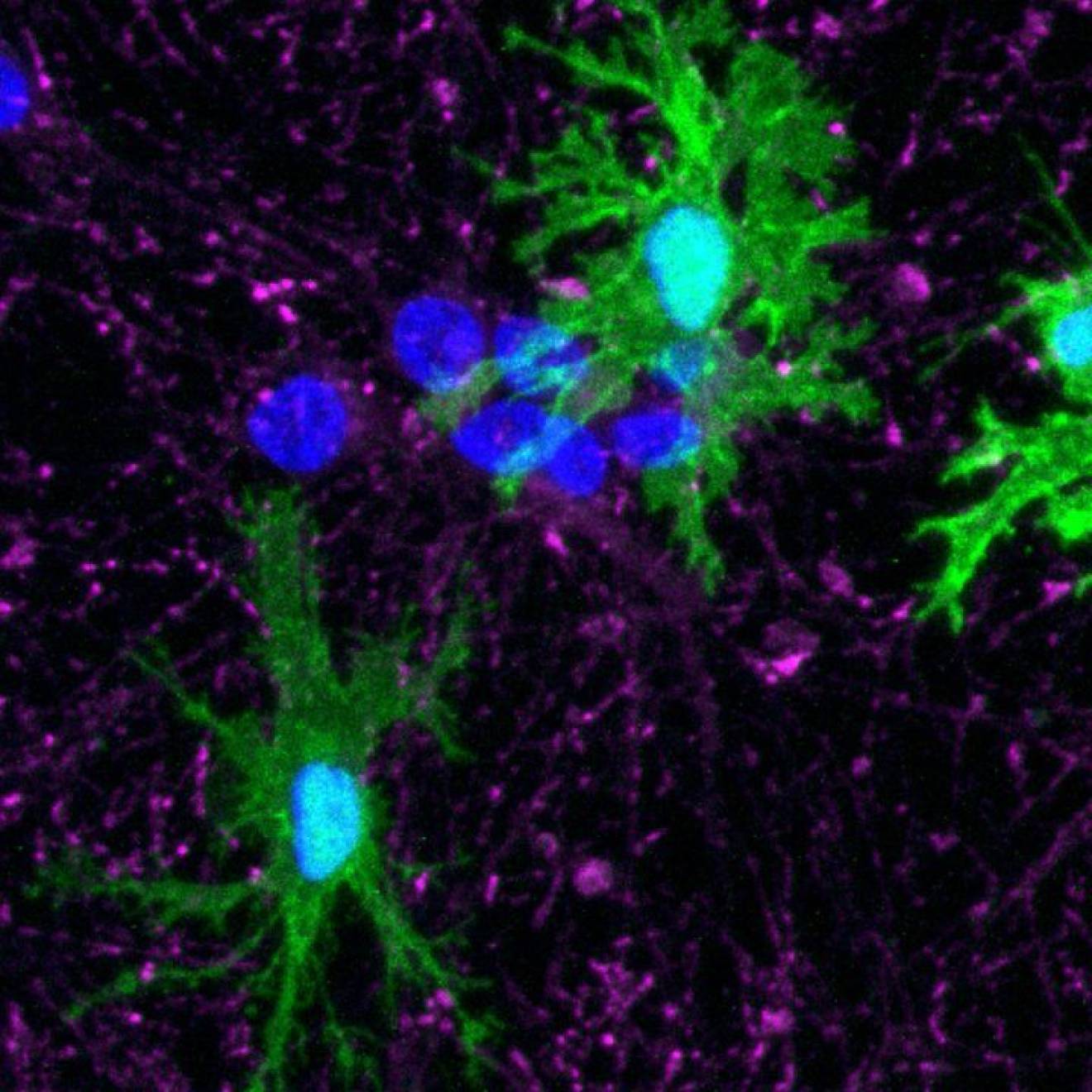 Close up image of microglia (green)