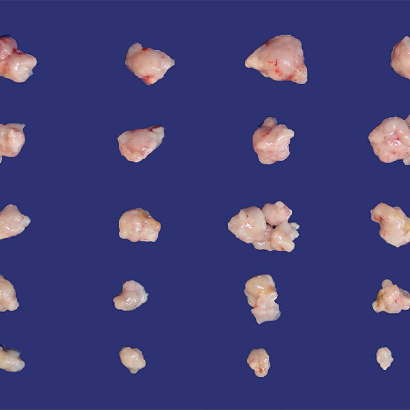 50 small tumors of different sizes, depending on how they are being treated