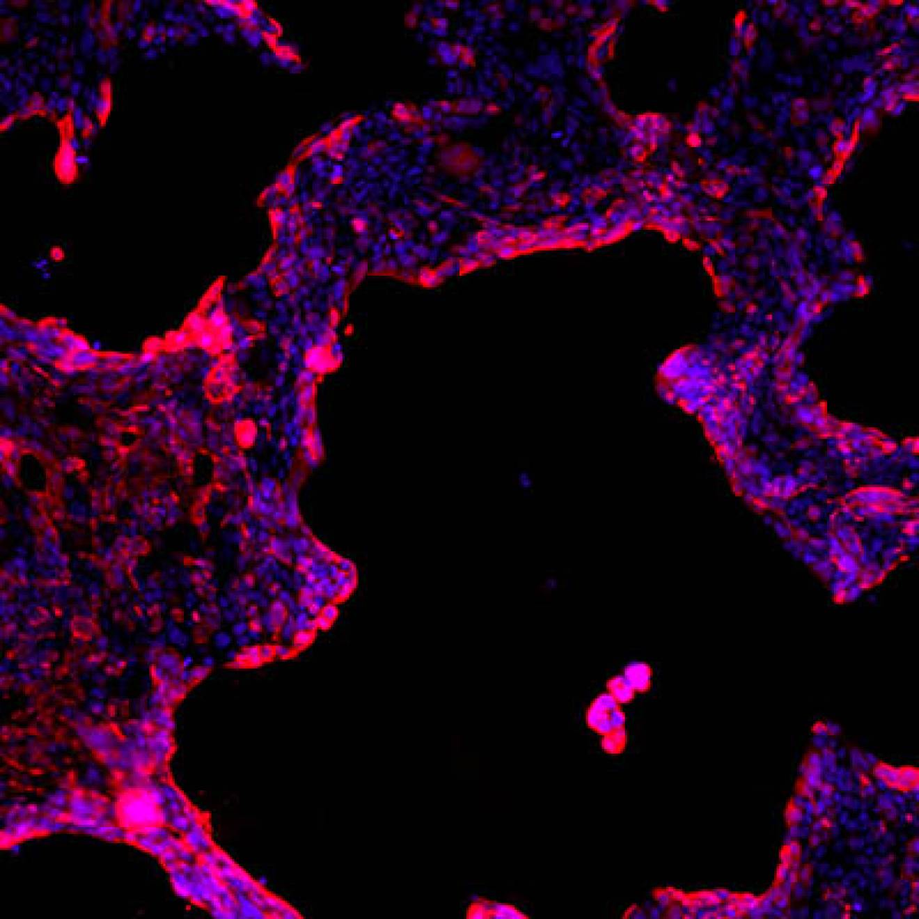 Human lung epithelial cells close up