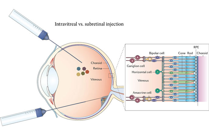 Injecting viruses into the eye