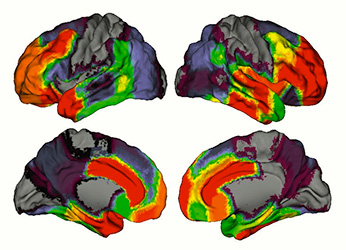 brain scans