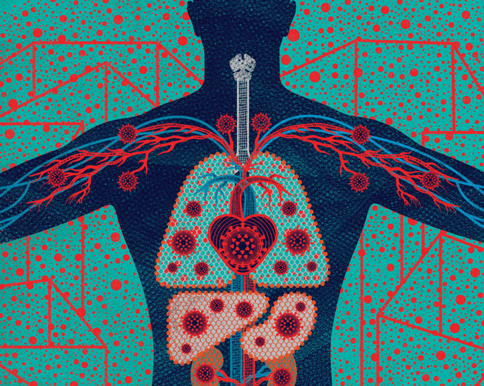 UCSF body map illustration